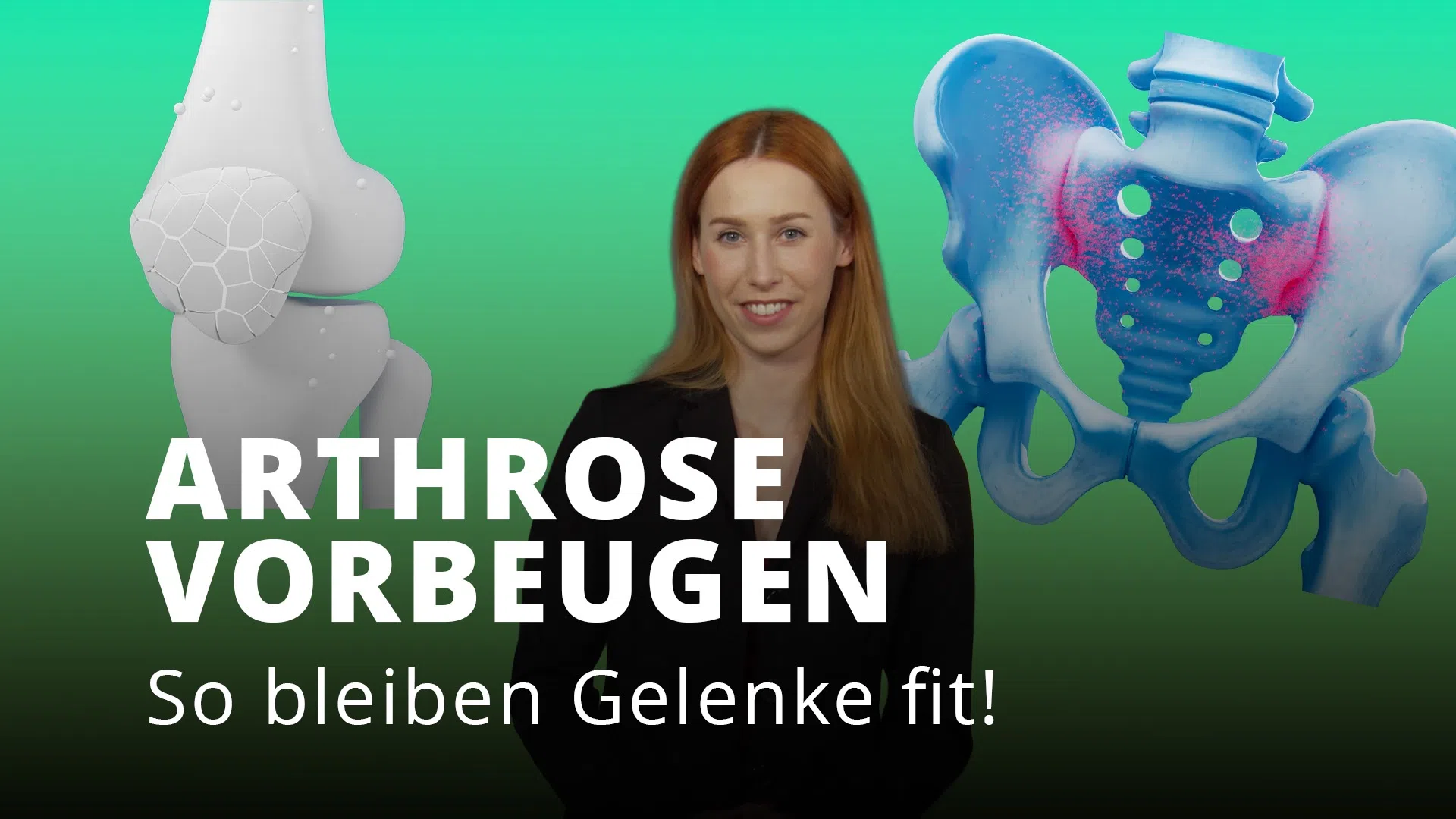 Arthrose verstehen: So beugst du Gelenkverschleiß effektiv vor