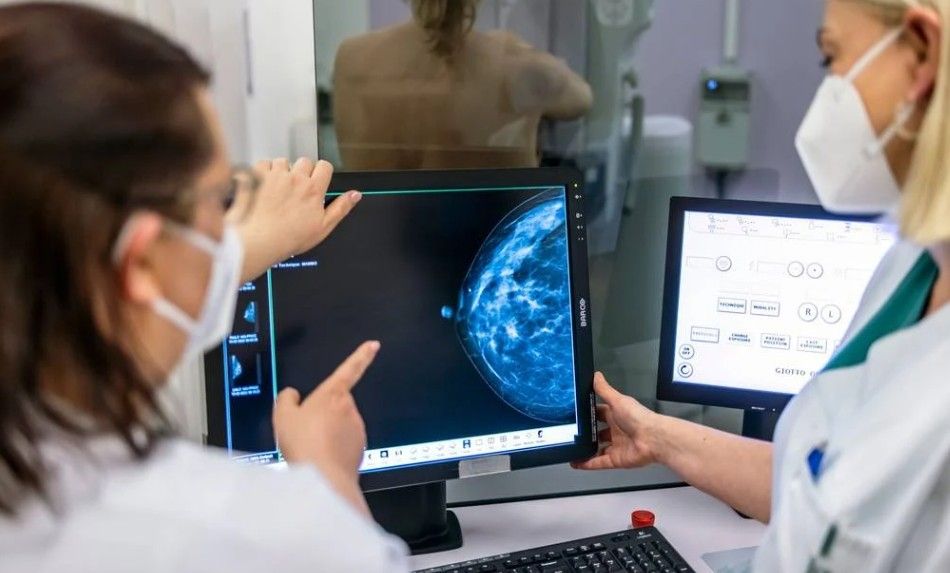 Brustkrebs häufigste Krebsneuerkrankung bei Frauen Brustkrebs häufigste Krebsneuerkrankung bei Frauen