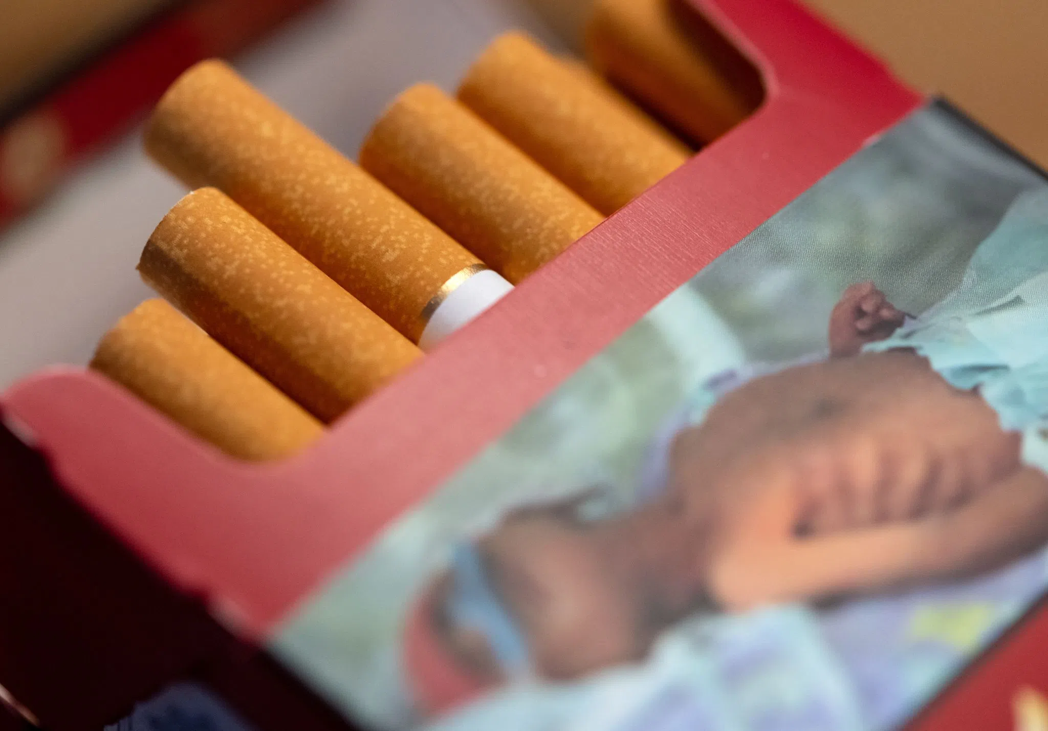 Männer leiden deutlich häufiger an Nierenkrebs als Frauen