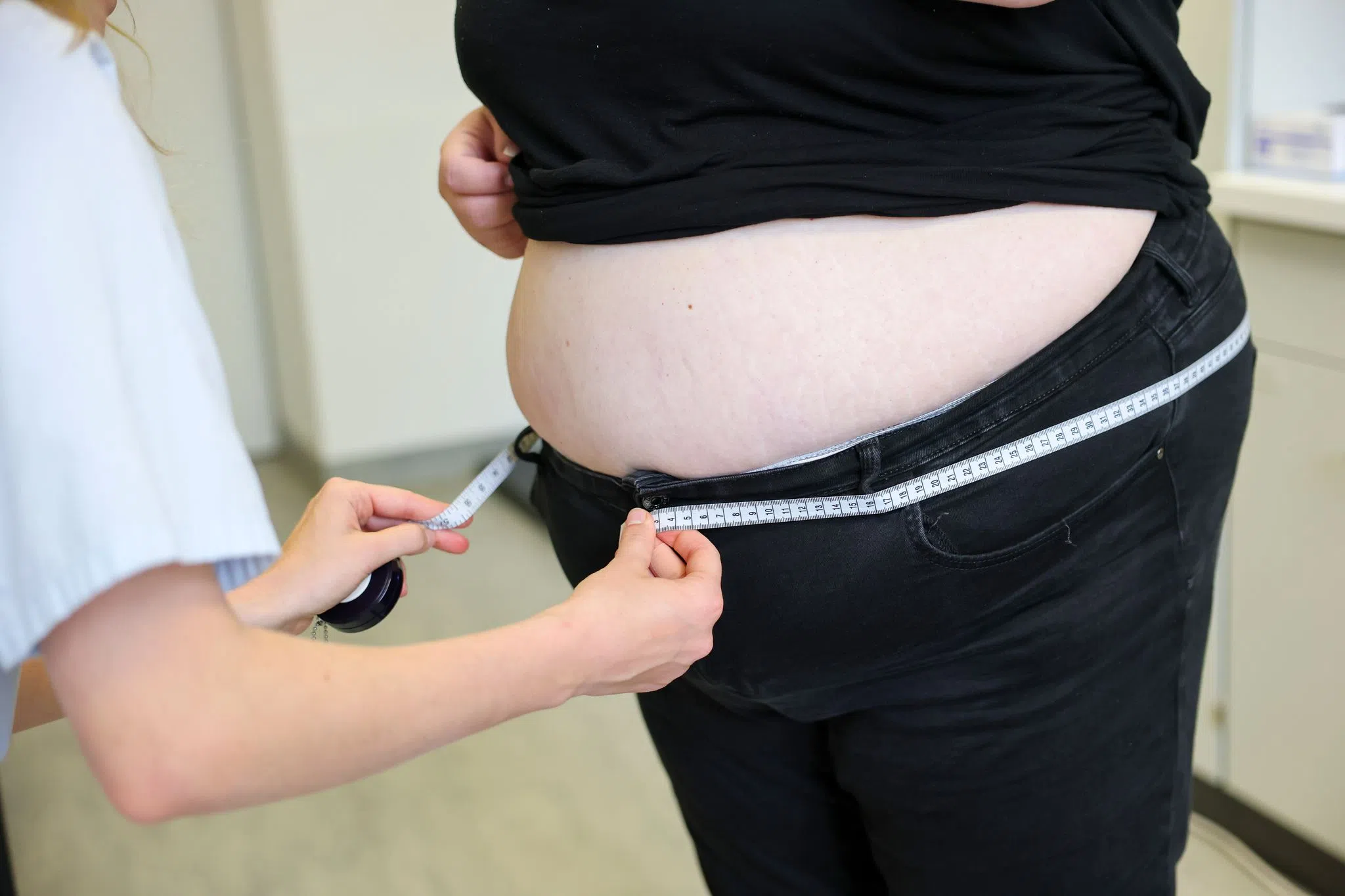 Krankenkasse: Es gibt immer mehr Übergewichtige