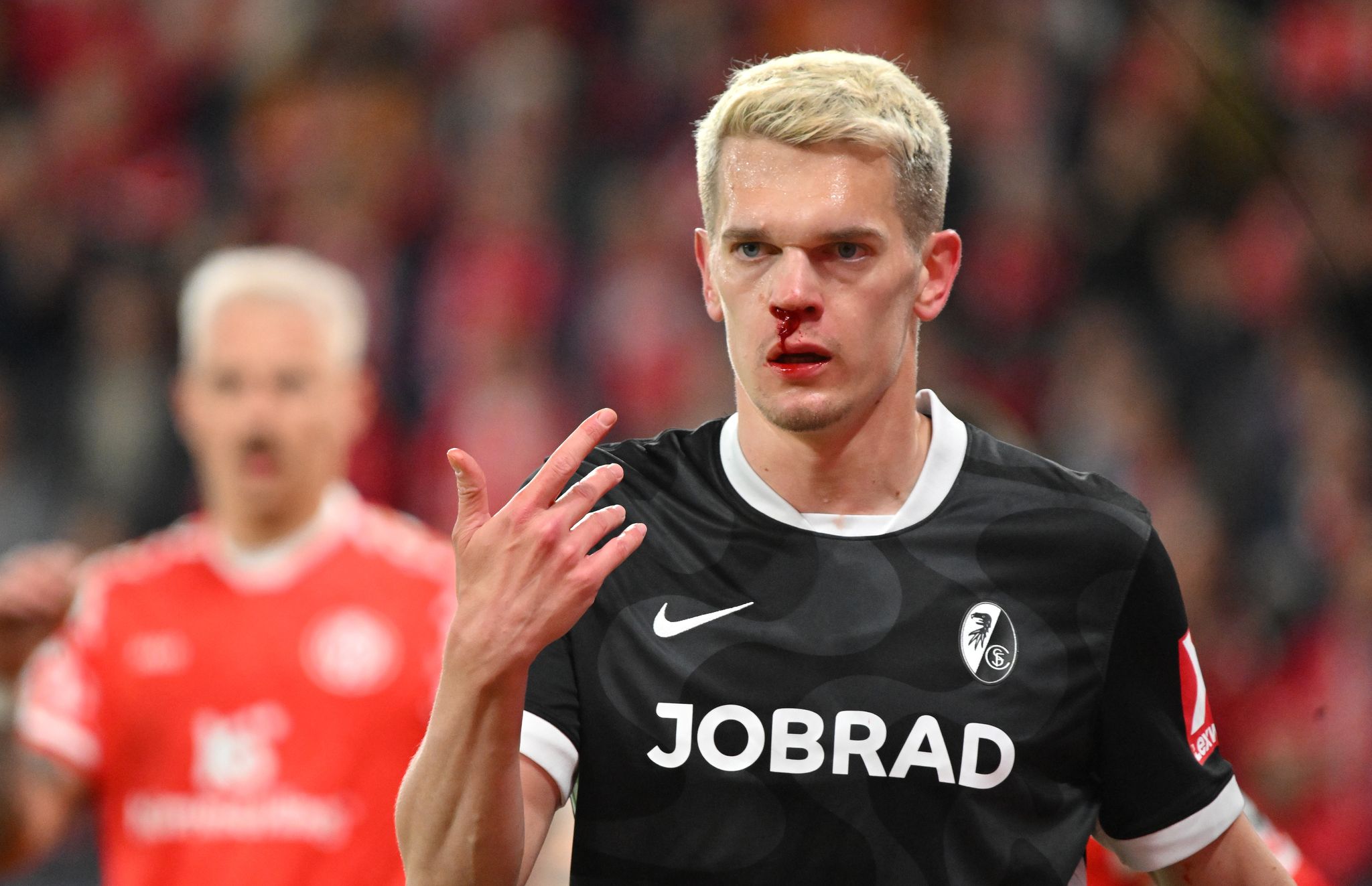 «Ich darf nicht lachen»: Ginters blutige Nase im Fokus