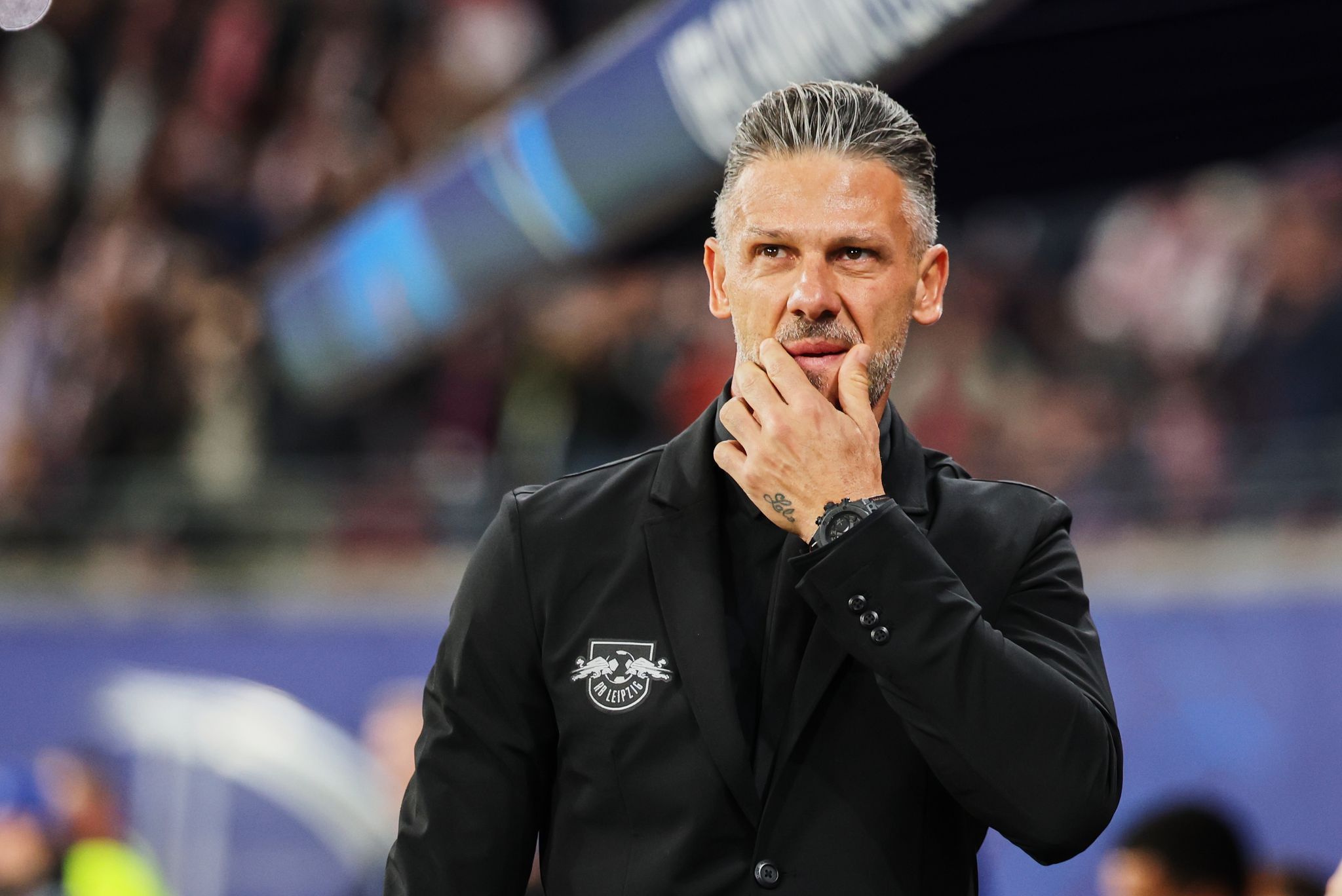 RB erwartet «ekliges» Elversberg - Demichelis bleibt positiv
